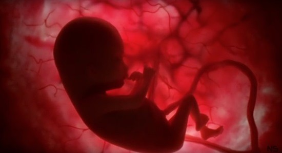 аборт дети страшилка