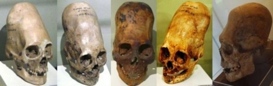 Боскопы история