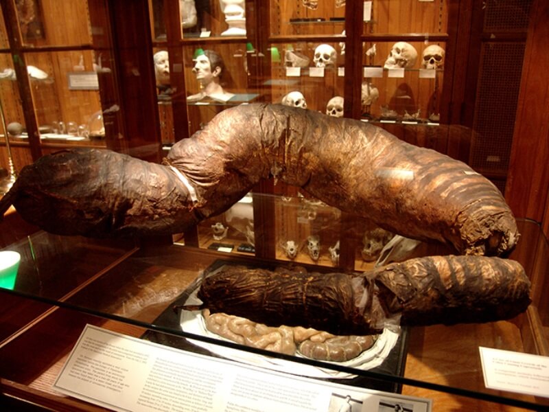 кишечник в Музеу Мюттера