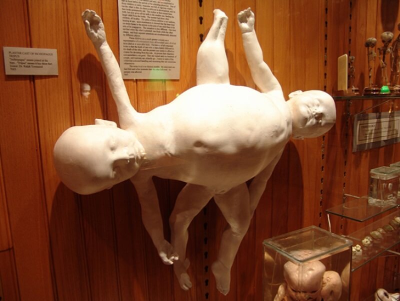 Музей Мюттера